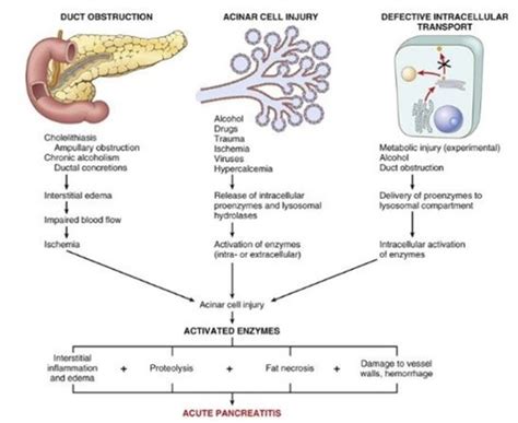 Pancreatic Pathology Flashcards Quizlet