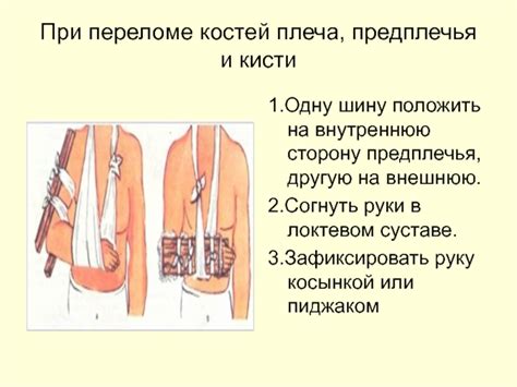 Переломы. Виды переломов. Первая помощь при открытых переломах