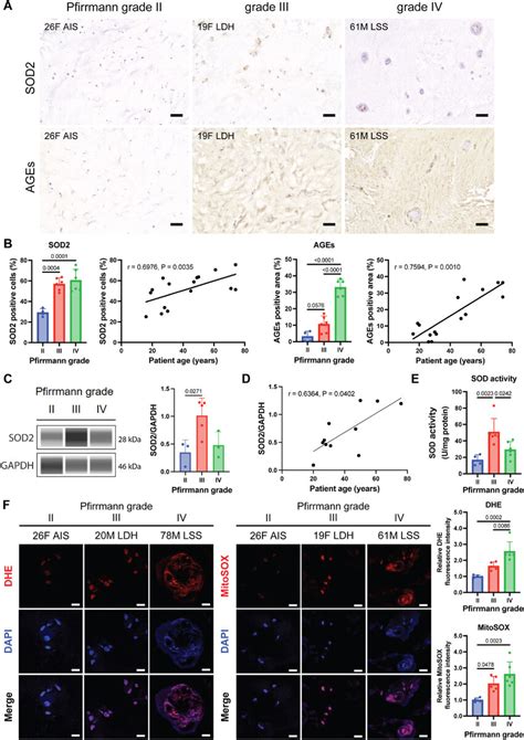 Expression Of SOD2 And Oxidative Stress Markers In Human IVD A