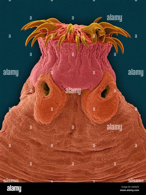 Coloured Scanning Electron Micrograph Sem Of Mammal Intestine Tapeworm Taenia Sp The Adult