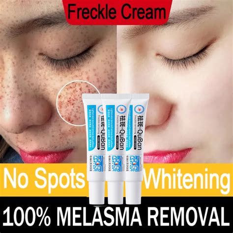 Days Whitening Freckle Cream Remove Dark Spots Melanin Melasma Cream