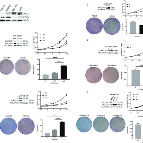 Otub2 Promoting Gastric Cancer Cell Proliferation Is Coincident With