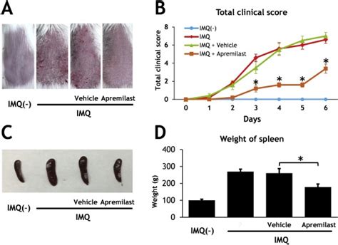 Apremilast Downregulates Interleukin Production And Induces Splenic