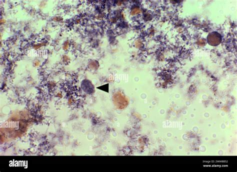 This Photomicrograph Of An Iron Hematoxylin Stained Specimen Revealed