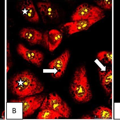 Shows Confocal Microscopic Images Of Hela Control Cells And Hela Cells