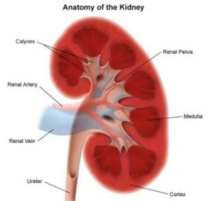 Caliectasis - Definition, Treatment, Symptoms, Causes