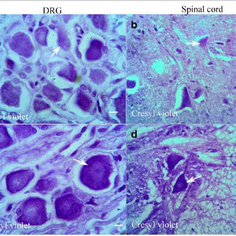 Light Photomicrographs Show Immunohistochemical Staining Of COX 2 In