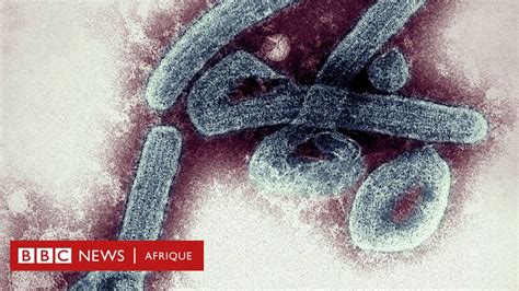 Virus De Marburg Le Ghana Confirme Les Premiers Cas Bbc News Afrique