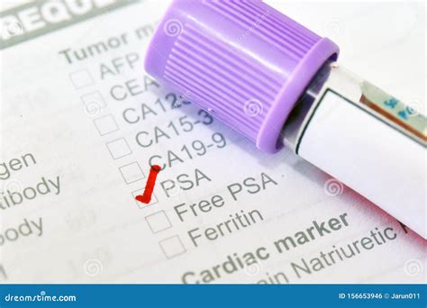 Blood Sample Tube For Psa Test Stock Photo Image Of Form Prostate