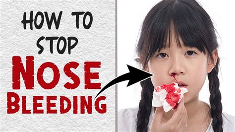 How To Stop A Nosebleed In Less Than 5 Minutes Home Remedies For