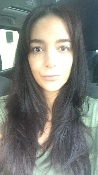 El Drama De La Mujer Que Perdi Por Completo Su Cabello Tras Dar A Luz