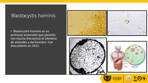 SOLUTION: Blastocystis hominis parasitologia presentacion - Studypool