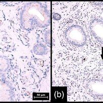 Immunohistochemical Expression Of Sox In Stromal Cells In Porcine And