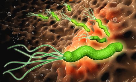 Helicobacter Pylori Sympt Mes Cancer Quel Traitement