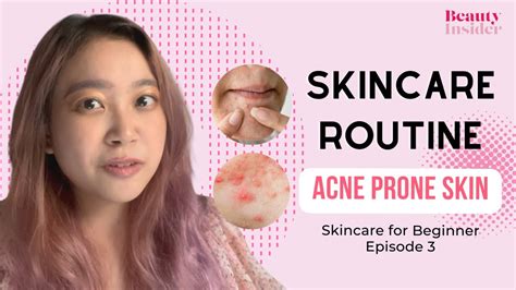 Skincare Routine For Acne Prone Skin Skincare For Beginner Episode 3