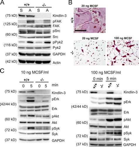 Impaired Adhesion And M Csf Signaling In Kindlin Pre Osteoclasts