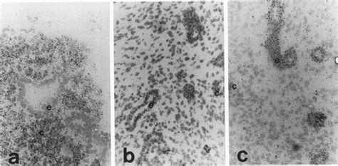 In Situ Hybridization Analysis Of PAX2 PAX8 And WT1 Gene Expression