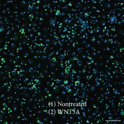 Differential β Catenin Immunoreactivity By Mscs Cultured Under Various Download Scientific