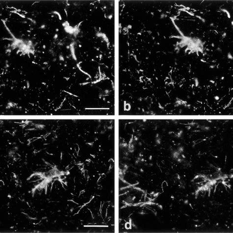 Double Immunofluorescent Staining Of Normal Human Brain With Either A