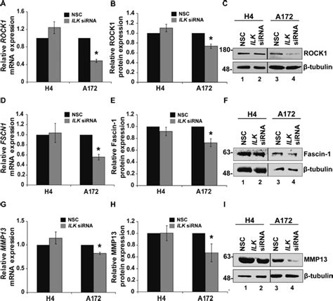 Ilk Silencing Suppresses Cell Migration And Invasion Of Glioblastoma