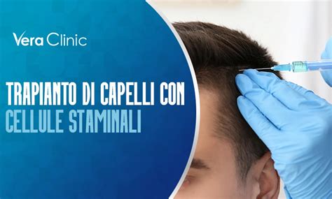 Trapianto Di Capelli Con Cellule Staminali Rivoluzionare Il Restauro