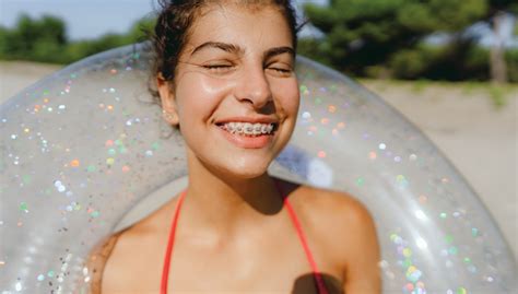 What Color Braces Should You Get? | Delta Dental