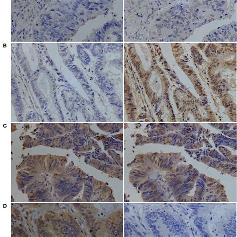 Representative Immunohistochemistry Analysis Of HLA G Expression