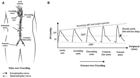 Morphological Change In The Arterial Pressure As The Contraction Pulse