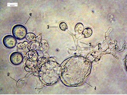 Mature isolate showing development of sporangia. 1, Hold-fast; 2 ...