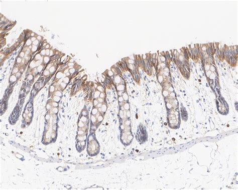 Kras Mouse Monoclonal Antibody A E Ha Huabio