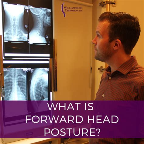 Tips For Forward Head Posture — Williamsburg Chiropractic