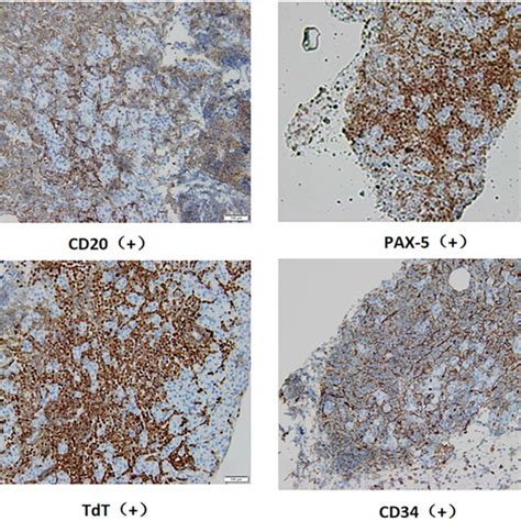 Representative Photomicrographs Of The Immunohistochemical Analysis Of Download Scientific