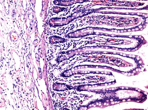 Normal Ileal Mucosa He Staining ×100 Download Scientific Diagram