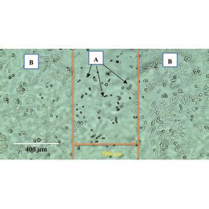 Iucr Effects Of Synchrotron Based X Rays And Gold Nanoparticles On