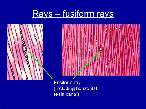 Softwood Anatomy Longitudinal Tracheids Earlywood And Latewood Earlywood