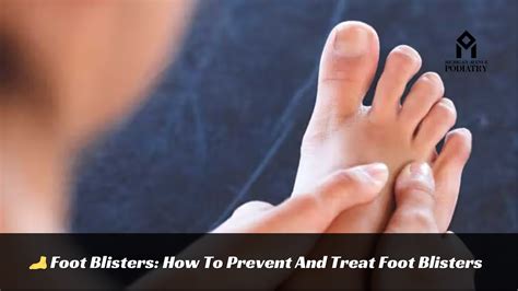 Foot Blisters How To Prevent And Treat Blisters