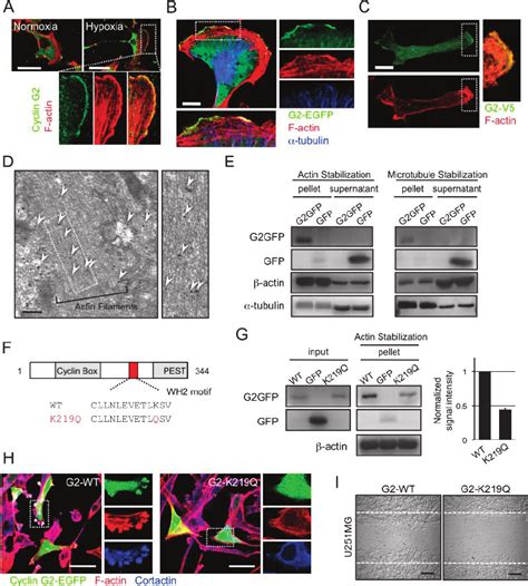 Cyclin G2 Interacts With Actin Filaments And The Interaction Is