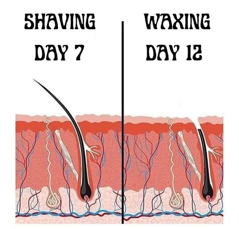 All Of Your Embarrassing Bikini Wax Questions Answered Artofit