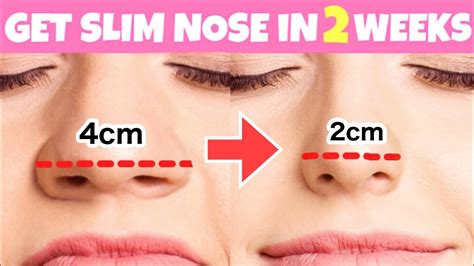 Make Nose Wings Smaller Slim Down Sharpen Wide Fat Nose No Surgery