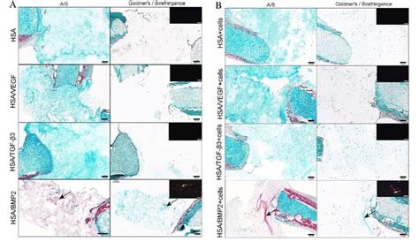 A S And Goldner S Trichrome Histological Staining And Polarized Light