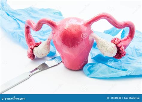 Concept of Gynecology Surgery. 3D Model of Female Uterus is Near Scalpel and Medical Gloves ...