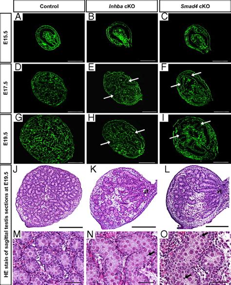 Activin A A Product Of Fetal Leydig Cells Is A Unique Paracrine