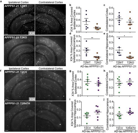 Comparison Of Fibrillar Amyloid Plaque Burden Across Trem Genotypes