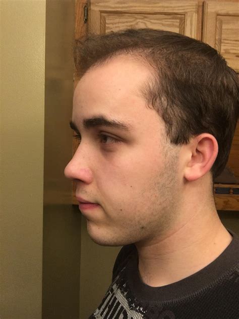 Professional advice on hairstyle for overweight men with thinning hair 17