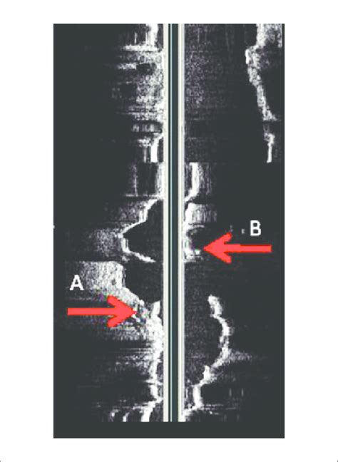 Originally obtained in-line digital image showing the proximal ...