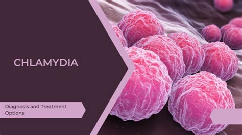 Ultimate Guide to Chlamydia: Diagnosis and Treatment Options