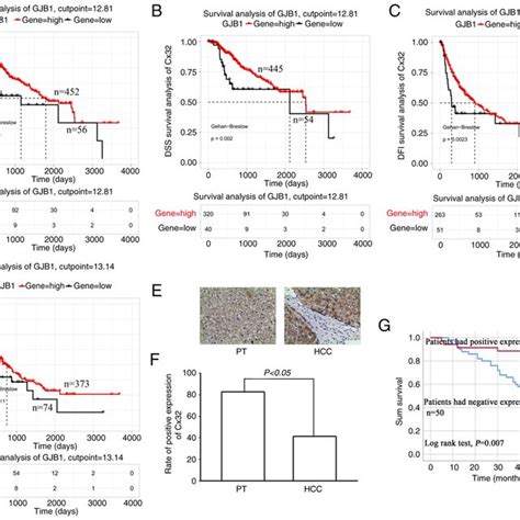 Cx32 Predicts Poor Prognosis In HCC Patients A D Survival Analysis