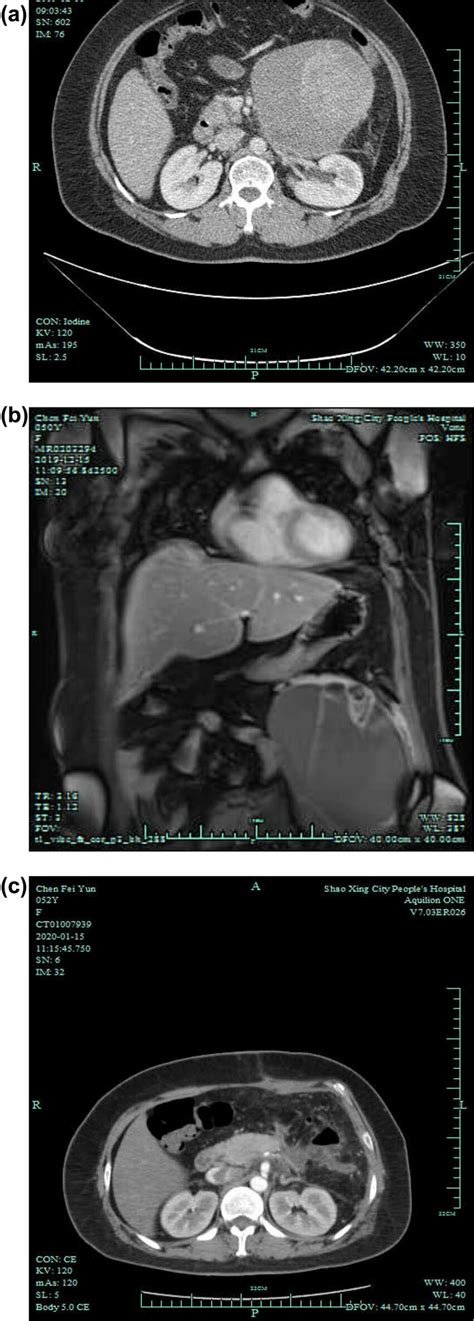 Imaging Examinations A Preoperative CT B Preoperative MRI The