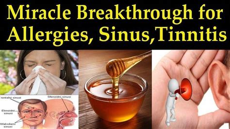 Miracle Breakthrough For Allergies Sinusitis And Tinnitus Sufferers