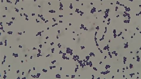 Leuconostoc Mesenteroides Introduction Morphology Pathogen